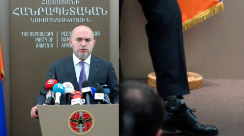 «Վստահ եմ՝ մեջը ժուչոկ կա». Աշոտյանը ցույց տվեց իր ոտքի «բռասլետը»