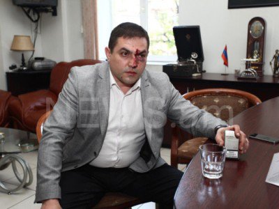 «Այս ամենի թիկունքում կանգնած է Արա Զոհրաբյանը». փաստաբանները ներկայացնում են հարձակման մանրամասները