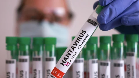 В Испании женщину проверяют на предмет заражения хантавирусом