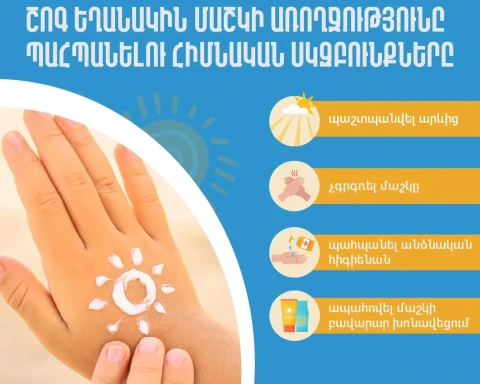 Ինչպե՞ս պաշտպանել մաշկը շոգ եղանակին